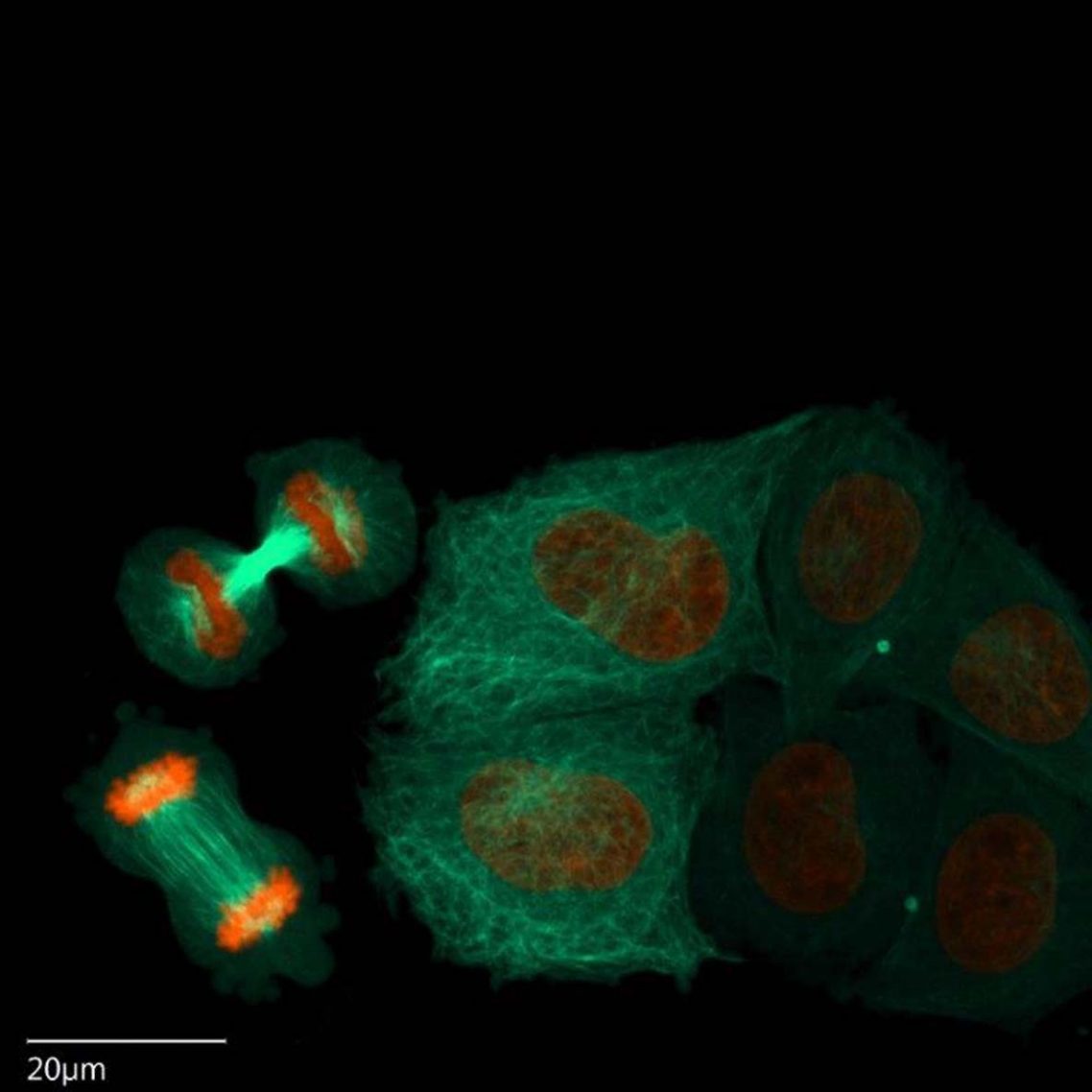 High Content Screening (HCS) Microplates Corning